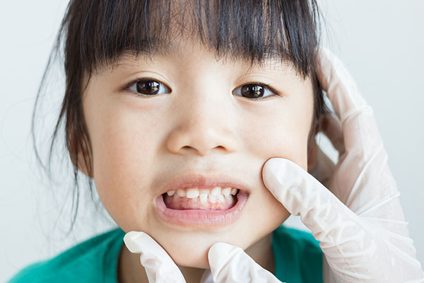 Pediatric Dental Health Benefits Of Drinking Water